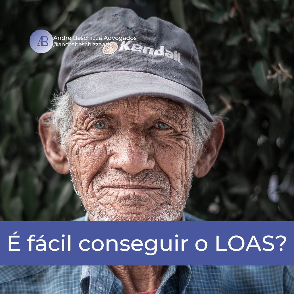 é facil conseguir o loas