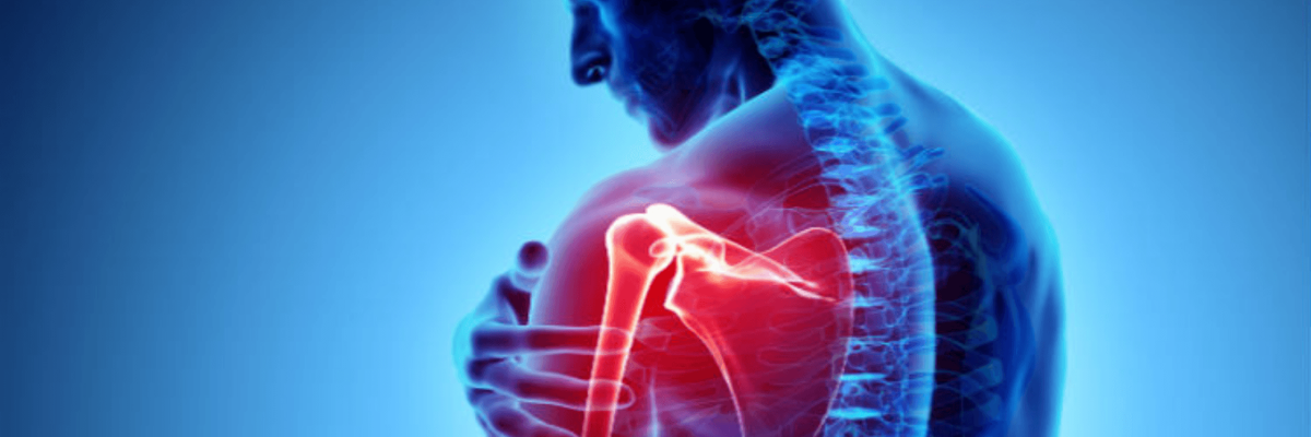 Lesão de Bankart Benefício Lesão de Bankart Benefício